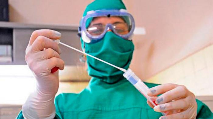  Pruebas diagnóstico COVID-19 