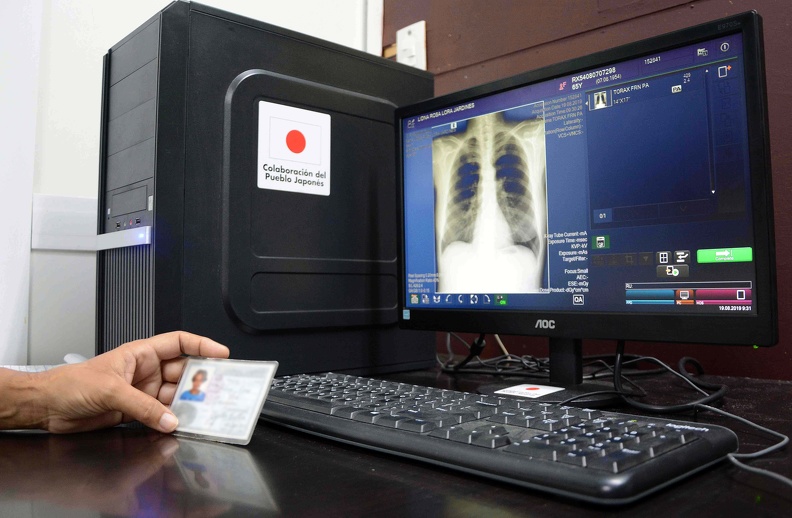 Incorporan hospitales santiagueros radiografías con tecnología digital