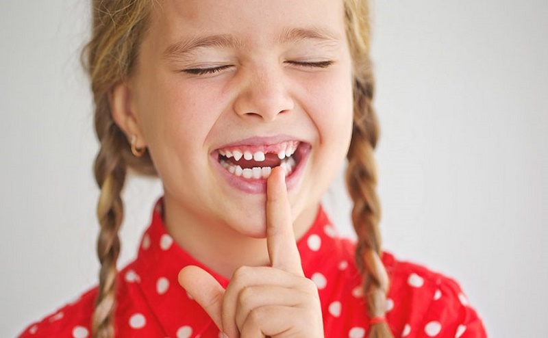 Todos necesitan conocer sobre los dientes de leche Todos necesitan conocer sobre los dientes de leche