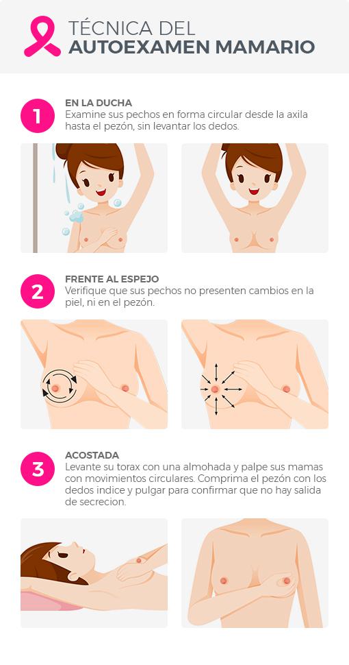 Examen de mamas